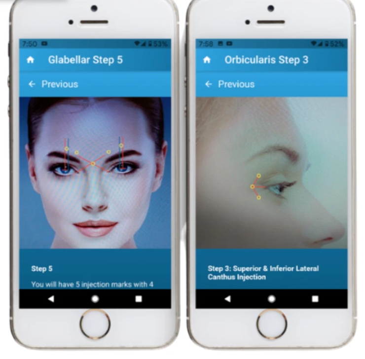 Botox Medical Training app showing Glabellar Step 5 and Orbicularis Step 3 injection marks